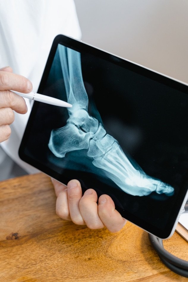 A doctor pointing to a digital X-ray of a foot displayed on a tablet